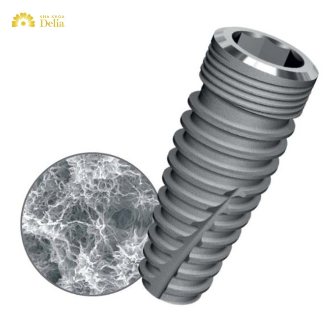 Ưu nhược điểm của trụ Implant NEO