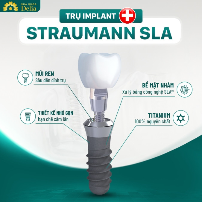 So sánh trụ Implant Nobel Active với trụ Implant Straumann Thụy Sĩ