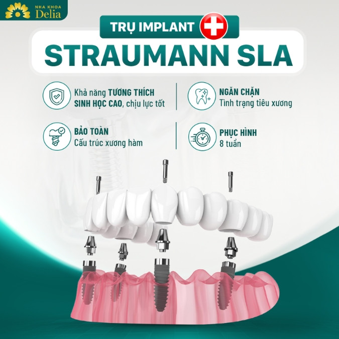 So sánh trụ Implant SIC với trụ Straumann Thụy Sĩ 