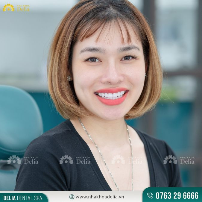 bọc sứ có độ bền lên tới hơn 20 năm nếu như biết cách chăm sóc tốt
