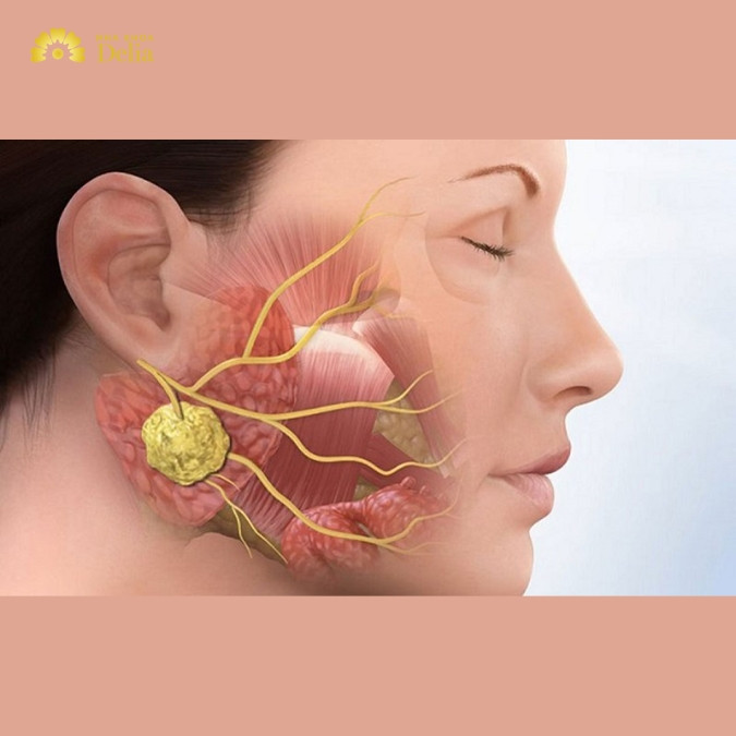 U xương răng là gì? U xương răng phát triển do đâu?