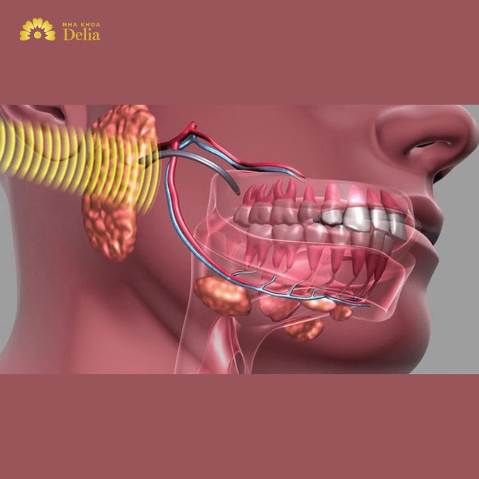 U xương hàm răng có phải là tình trạng nguy hiểm? 