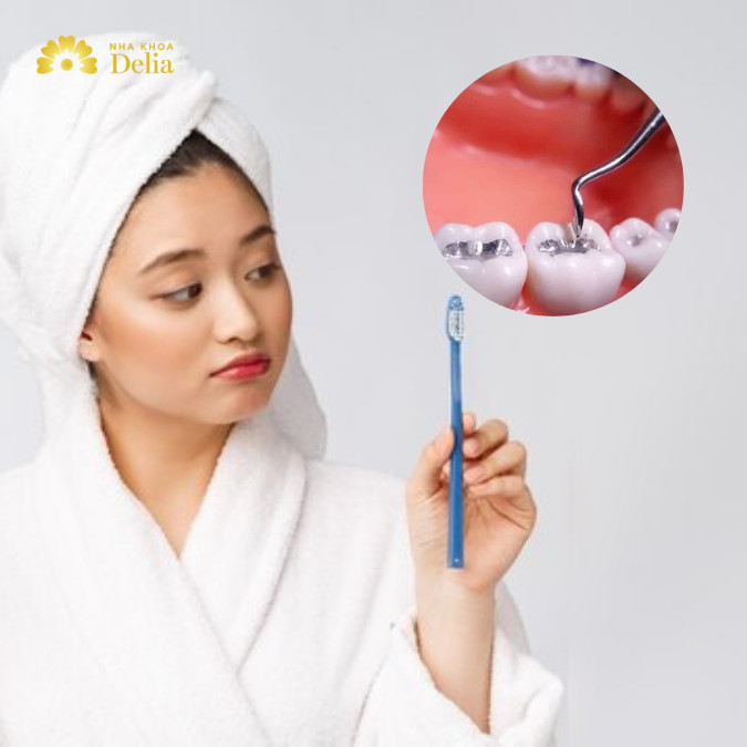Mới trám răng có được đánh răng không, cần đợi bao lâu?
