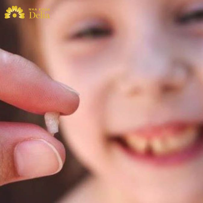 Nằm mơ thấy răng màu đen rụng