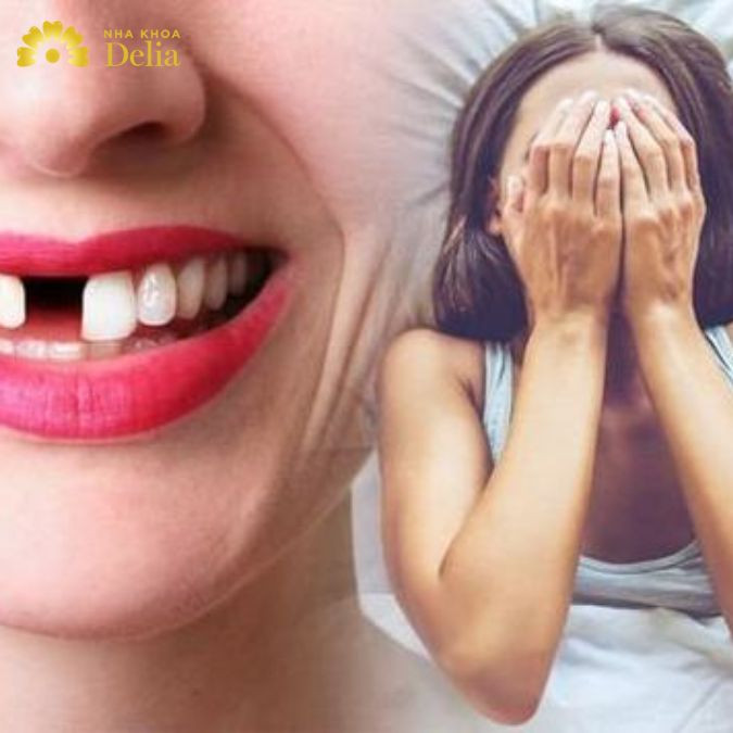 Mỗi giấc mơ thấy rụng răng đều mang một ý nghĩa hoàn toàn khác nhau