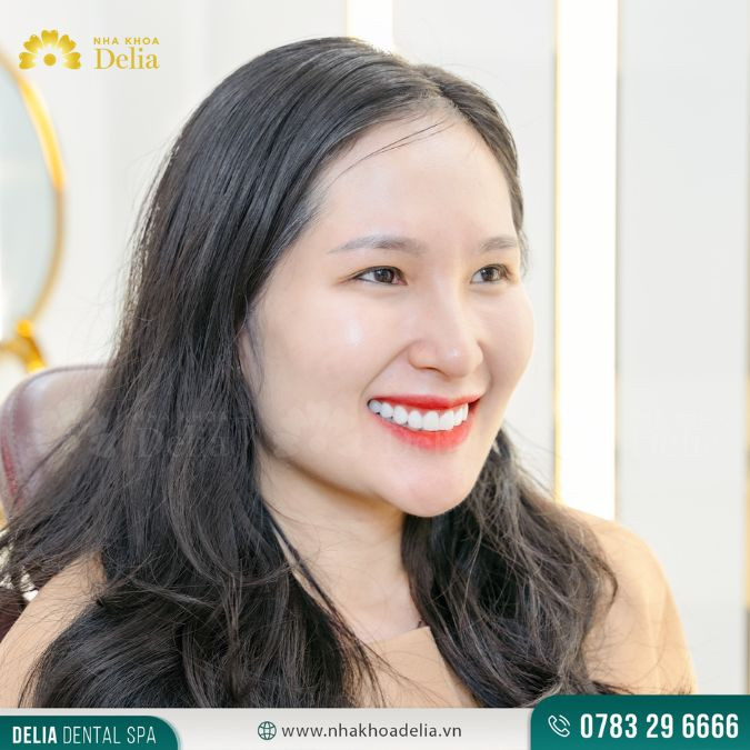 kết quả tẩy trắng răng ở mỗi người là hoàn toàn khác nhau vì tùy thuộc vào tình trạng răng miệng thực tế