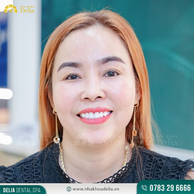 Bạn nên sử dụng nước súc miệng dành cho răng nhạy cảm