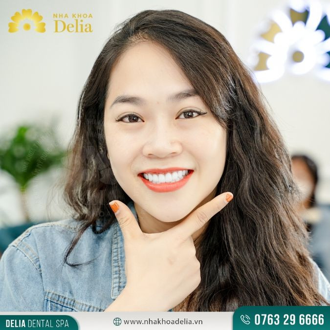 Trám răng bao nhiêu tiền