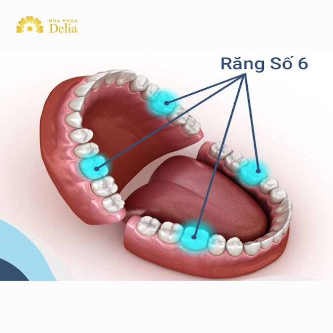 Trám răng số 6 bao nhiêu tiền? Bảng giá trám răng, chữa tủy 2024