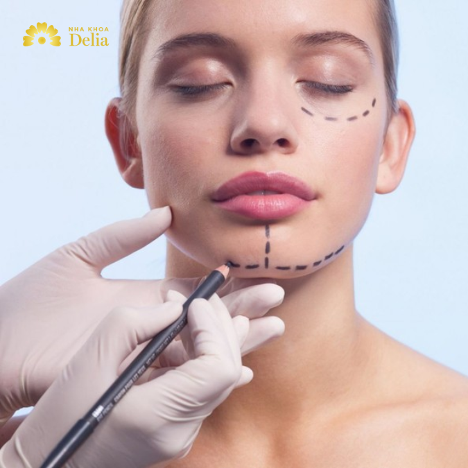 Phẫu thuật thẩm mỹ chữa mặt lệch nặng