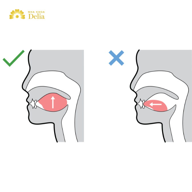 Bài tập Mewing cho mặt lệch nhẹ