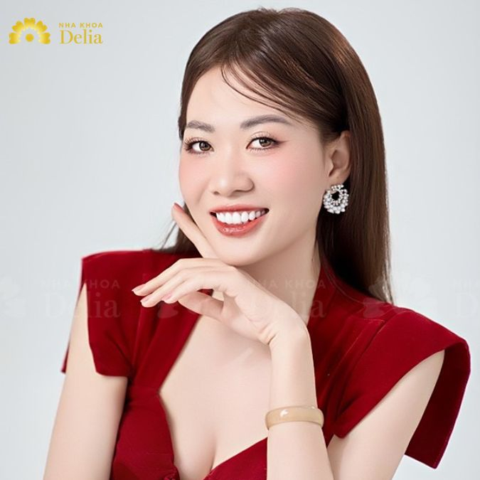Dấu ấn làm nên xu hướng răng sứ Celeb đến từ màu sắc trắng sáng và cảm giác khuôn mặt thon gọn chuẩn ngôi sao
