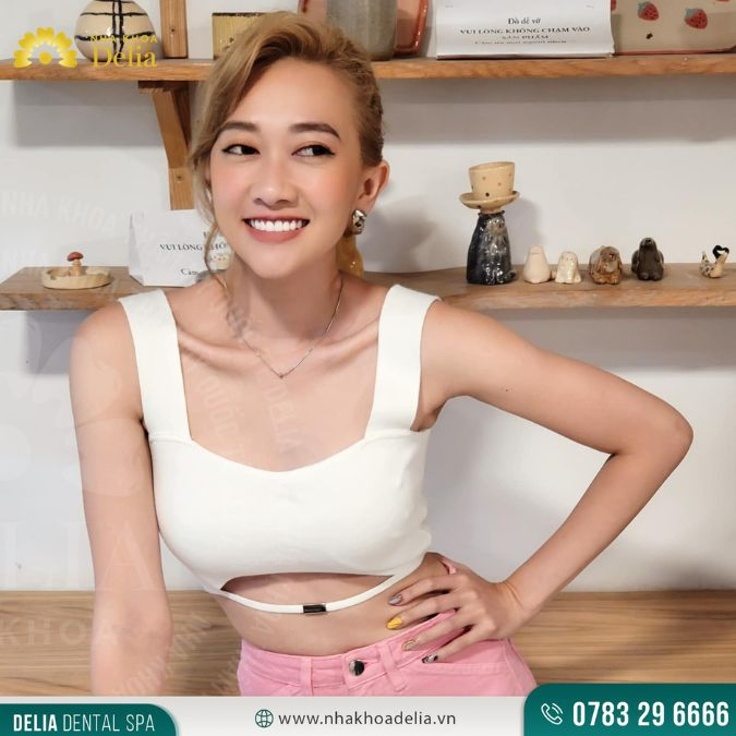 Người nổi tiếng, có sức ảnh hưởng thích hợp với dáng răng sứ Celeb