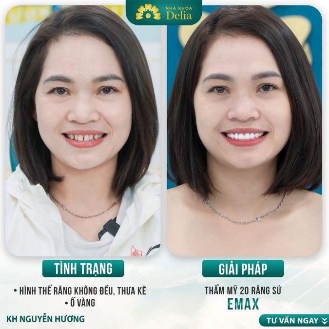 Đến với Delia, khách hàng đều được tư vấn và giải đáp tận tình cùng bác sĩ chuyên môn
