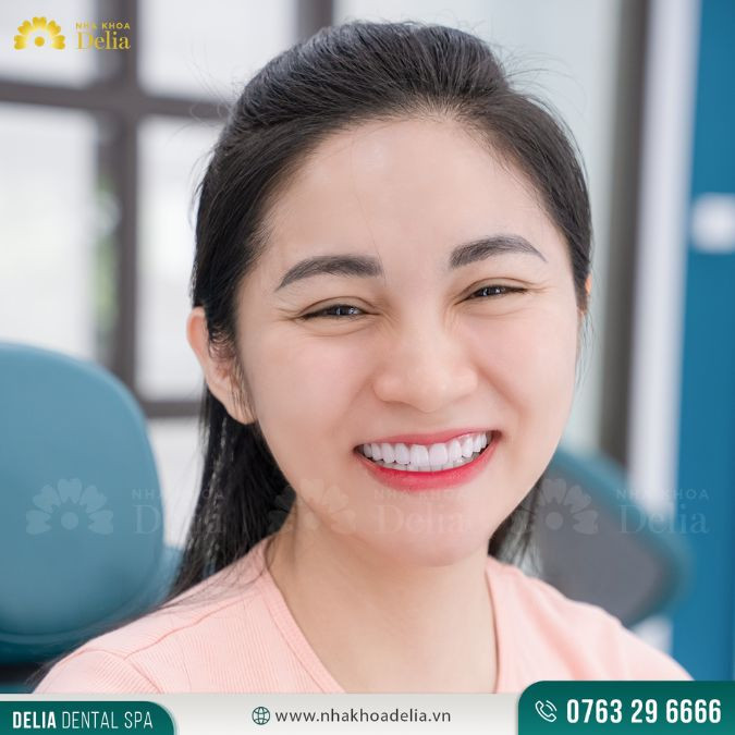 Chị Gianna Huỳnh (Kiều bào Mỹ) chia sẻ: “Chị thấy màu răng, dáng răng phù hợp với người châu Á"