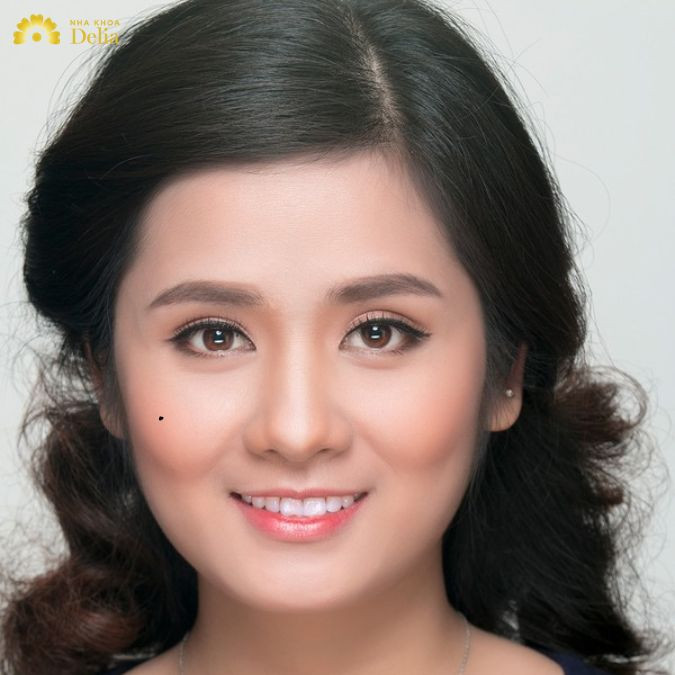 HÌNH ẢNH MINH HỌA GÒ MÁ CAO VỚI ĐƯỜNG NÉT NHÔ LÊN Ở VÙNG MÁ