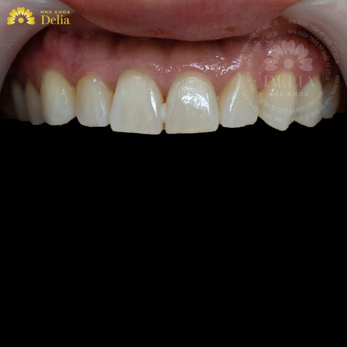 Vệ sinh răng miệng đúng cách