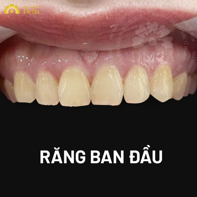 Hạn chế ăn thực phẩm có mùi khó chịu