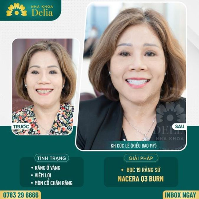 Chị Cúc Lê - Kiều bào Mỹ