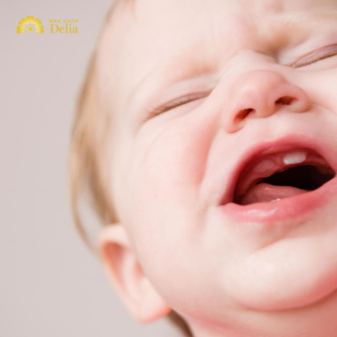 Mọc răng cấm có sốt không?