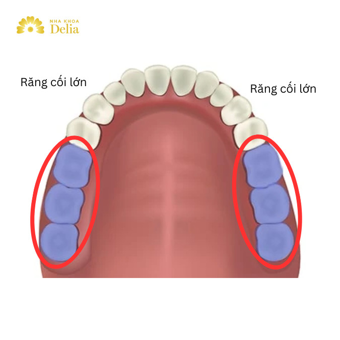 Răng cối lớn gồm 6 chiếc ở mỗi hàm