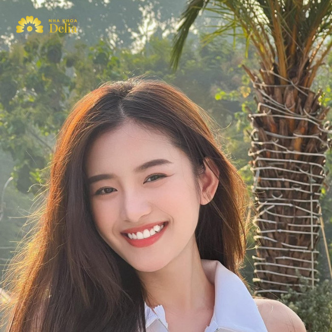 Răng khểnh có thể do di truyền
