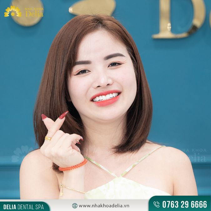 Sứ Emax