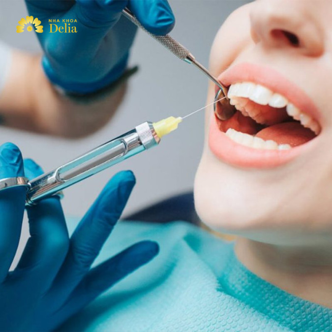 Tiêm thuốc tê vào răng có đau không? Giải đáp A – Z về tiêm tê nhổ răng