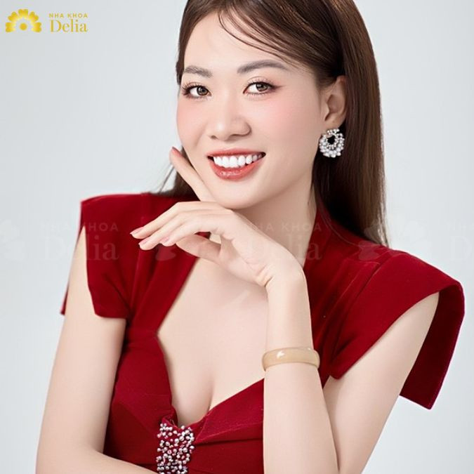 Dán sứ Veneer