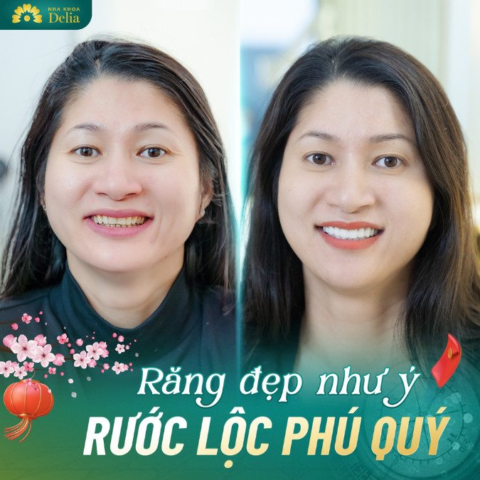 Lợi ích khi sở hữu hàm răng chuẩn: Cải thiện khả năng ăn nhai