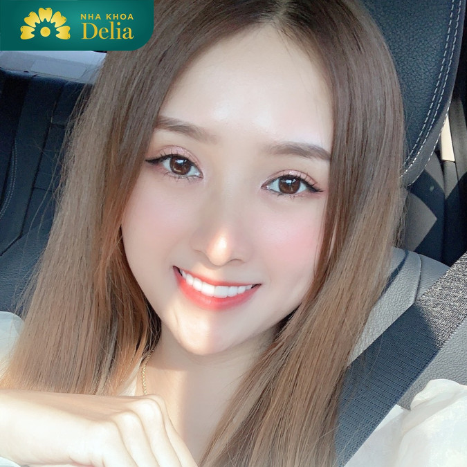 Lợi ích khi sở hữu hàm răng chuẩn: Nụ cười đẹp, có tính thẩm mỹ cao