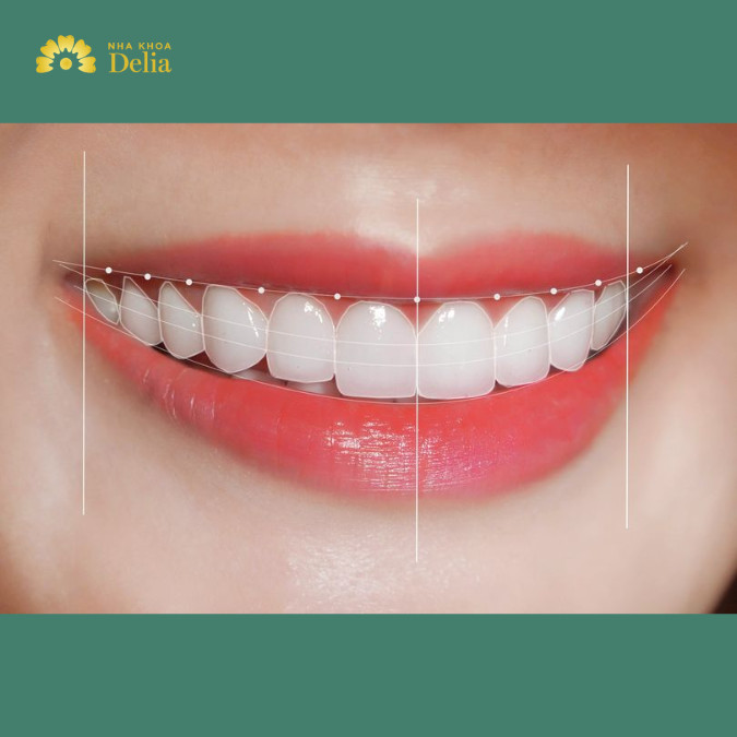 Dấu hiệu của hàm răng chuẩn: Đường cong cung răng cân xứng