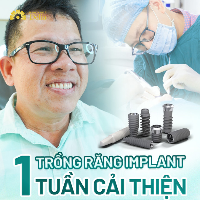 Hành trình trồng lại răng Implant sau khi gặp nhiều biến chứng của Việt kiều Mỹ Quách Gia Đoan