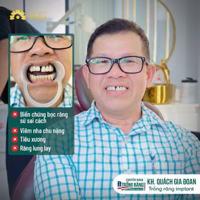 Bọc răng sứ và trồng răng Implant tại địa chỉ không uy tín khiến anh Đoan gặp nhiều biến chứng