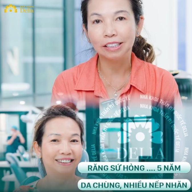 Câu chuyện làm đẹp tại Delia của chị Hoài Lê