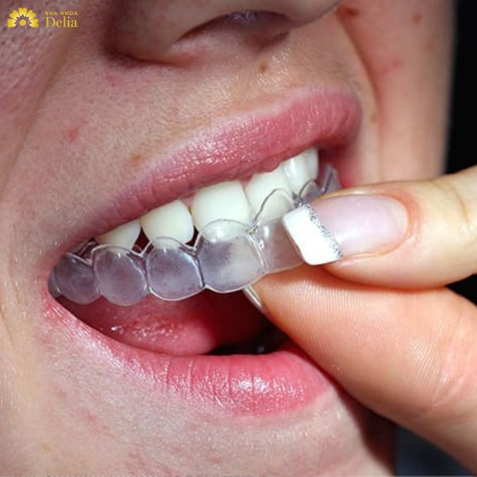 Sử dụng máng nhai