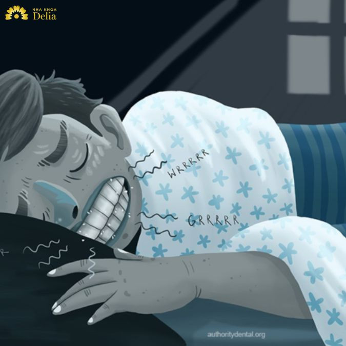 Một số yếu tố liên quan đến khớp cắn cũng có thể là yếu tố ảnh hưởng tới việc bạn nghiến răng khi ng