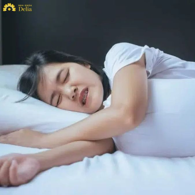 Nghiến răng là một hoạt động khiến cho hệ thống nhai bị quá tải