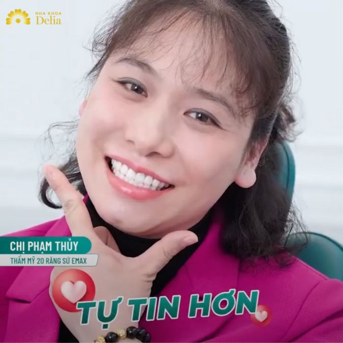 Hành trình thẩm mỹ 20 răng sứ Emax của chị Phạm Thủy