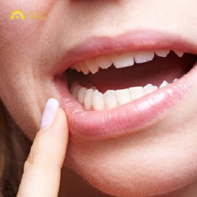 Răng hàm lung lay có thể chắc lại nhưng tùy trường hợp