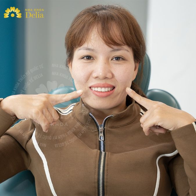 Niềng răng
