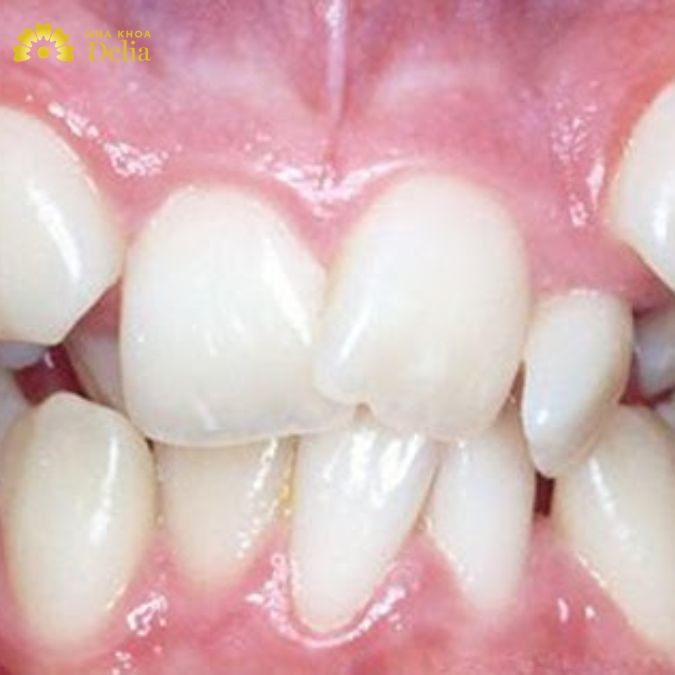 Tuy rằng có nhiều điểm giống nhau nhưng thực chất hai phương pháp này có nhiều điểm khác biệt