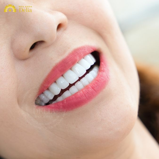 Tỷ lệ giữa nướu và răng chuẩn