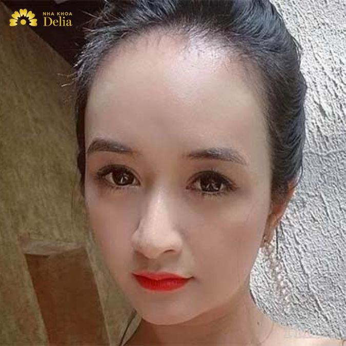 Nếu để đánh giá một cách khách quan thì đây là điểm không đẹp