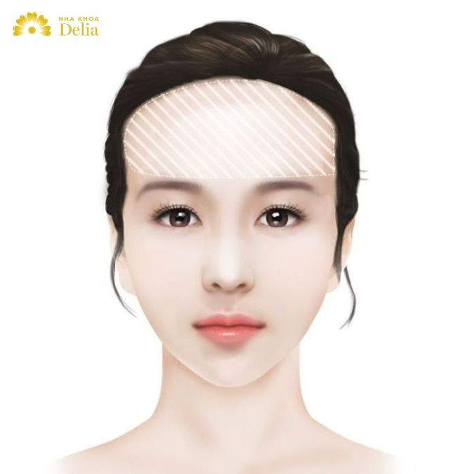 Trán rô là trán rộng, ở giữa hai lông mày cho đến đường chân tóc có khoảng cách lớn