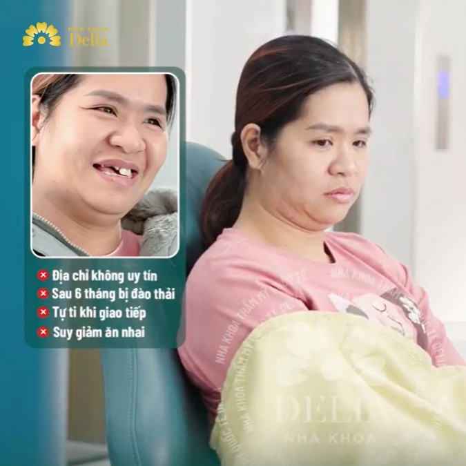 Trụ Implant bị đào thải do trồng răng siêu rẻ ở quê nhà