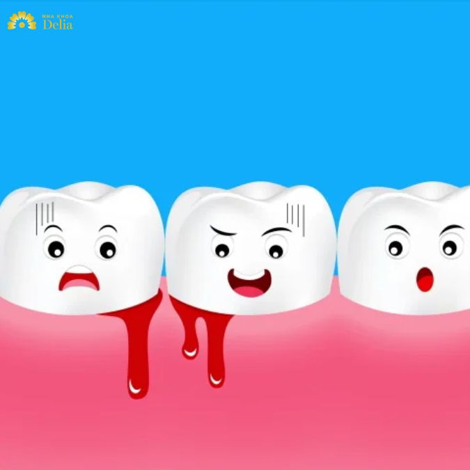 Chảy máu là một trong những rủi ro có thể xảy ra khi nhổ răng cấm