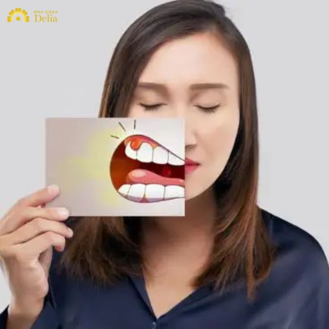 Điều trị viêm lợi sưng má
