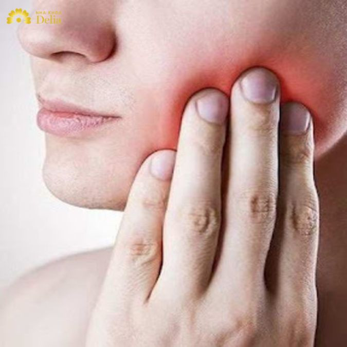 Tụt lợi hay lợi tách khỏi nướu là một biến chứng nguy hiểm của viêm lợi sưng má nếu không được điều trị kịp thời