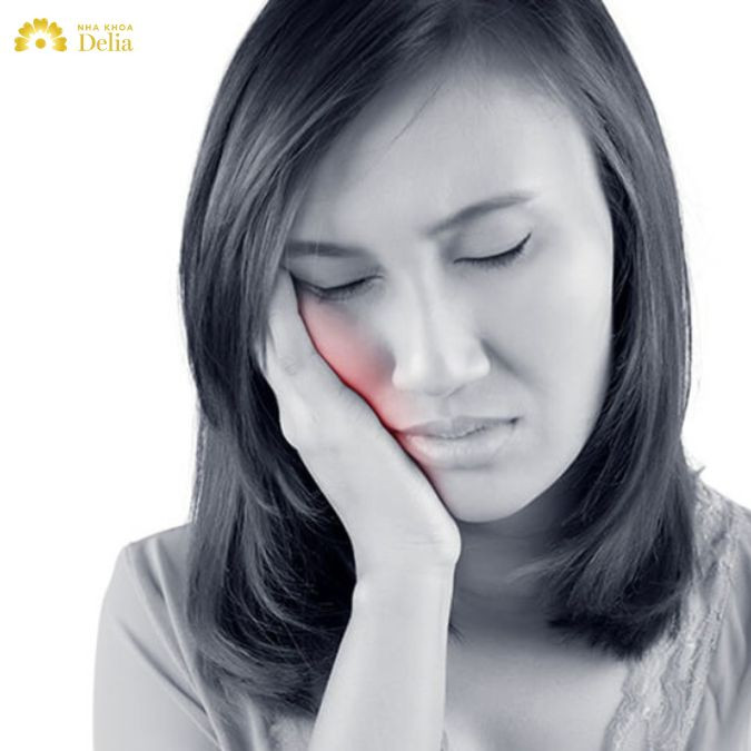 Viêm lợi sưng má là biểu hiện của tình trạng viêm nhiễm lan rộng từ lợi sang các mô xung quanh